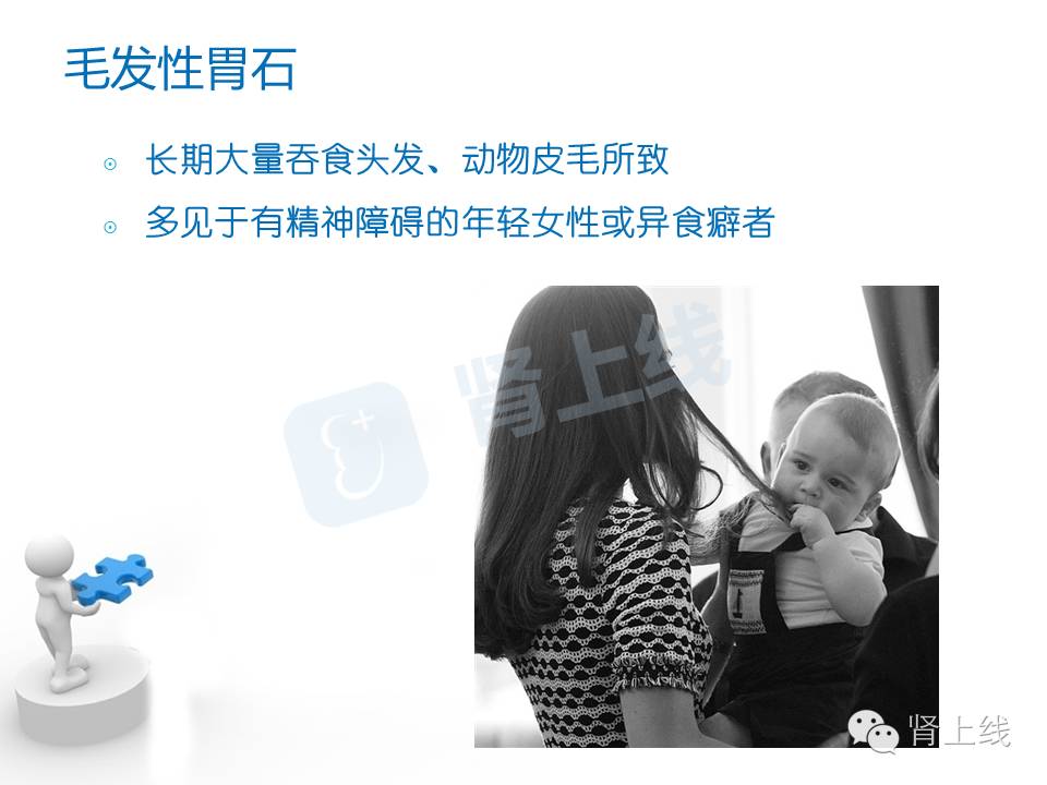 吃山楂取出胃结石,吃10个山楂胃结石有多少