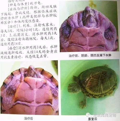 龟水肿的治疗方法,龟水肿是什么症状