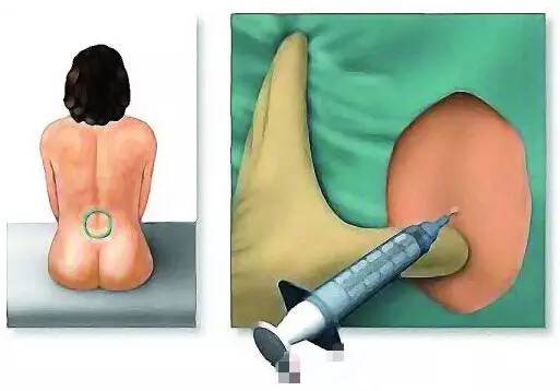 生孩子真的有断10根肋骨那么痛吗,分娩相当于断了几根肋骨