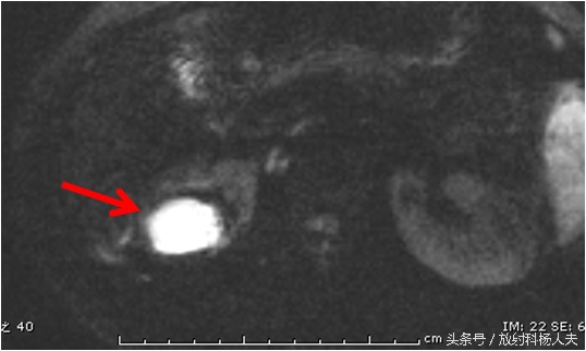 花季少女腰疼是什么原因,青春期女生为什么总是腿痛