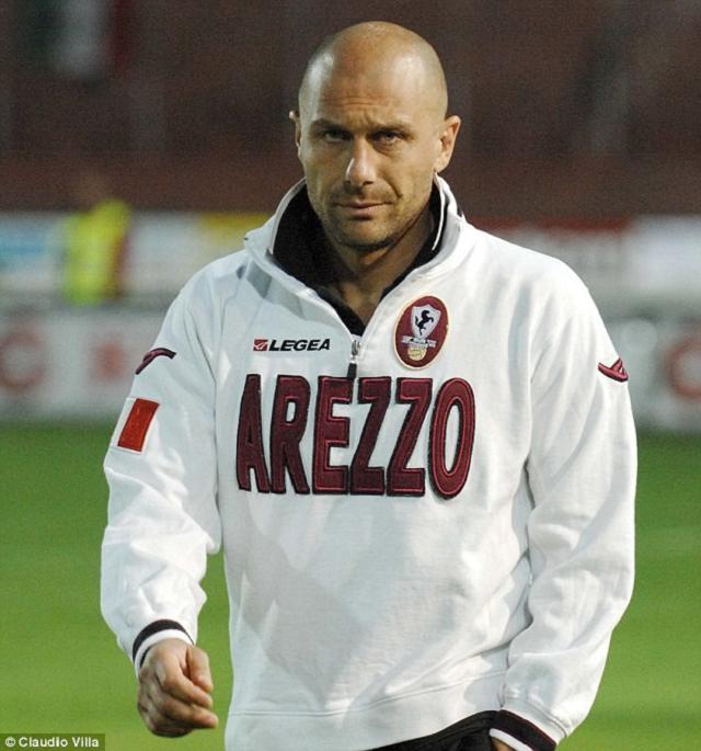 孔蒂植发效果图,孔蒂脱发