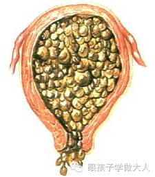 准妈妈有这3个特征,准妈妈出现这些现象