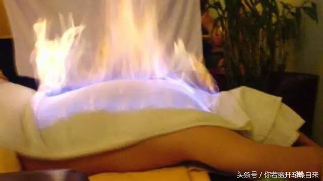 中医理疗火疗,中医的火疗是什么