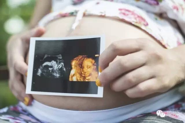 准妈妈要当心孕期最易犯的小错误,孕检四大误区谨慎别踩雷