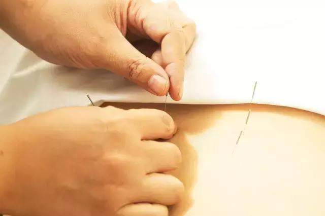 痛经的原因推拿治疗,广州荔湾国医馆针灸痛经有用吗