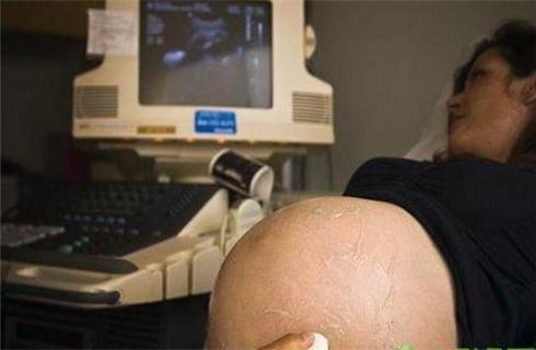 孕期出现这六种不适必须马上就医,孕妇孕期多种病症