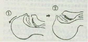 冠心病突发急救方法中医,老人突发冠心病怎么急救