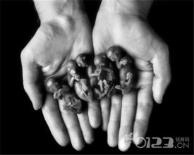 五个月死胎孕妇会出现什么症状,如果是死胎孕妇有什么症状