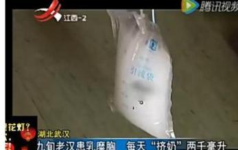 90后艺人徐婷去世原因,艺人徐婷淋巴癌症状