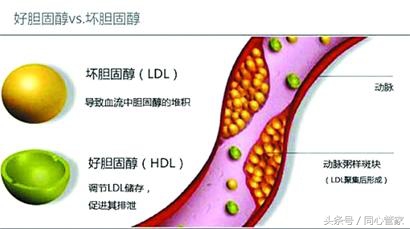 他汀类有几种哪种最好降胆固醇用,阿托伐他汀和瑞舒伐他汀降胆固醇
