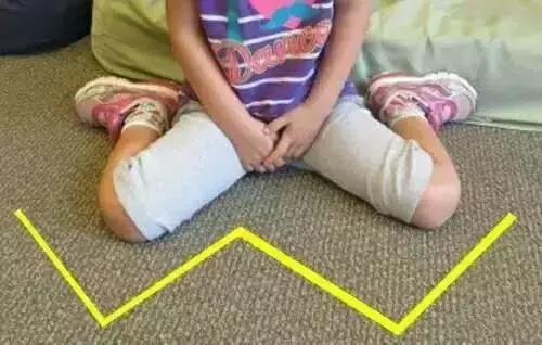 家长四种行为对孩子的影响,宝宝骨骼发育有影响怎么办