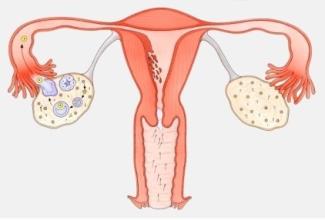 每个人都应知晓的肿瘤防治科普系列：卵巢癌的预防、筛查和预警