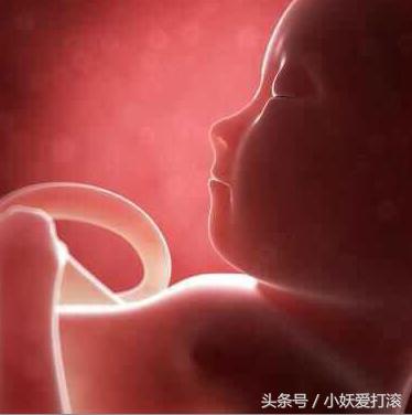 31周+3破水，医院保胎18天，宝宝4斤9两希望健康早点出院