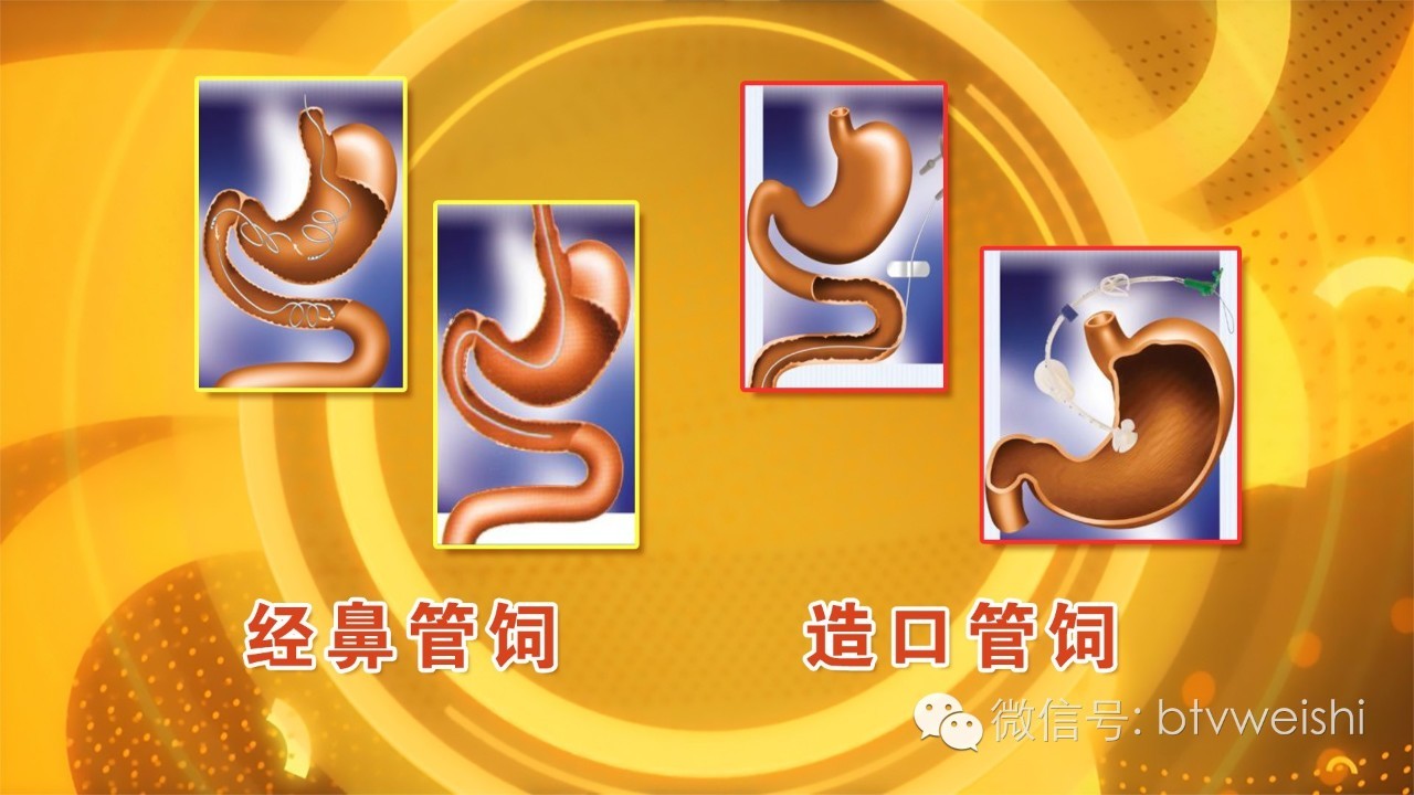 养生堂今日17:25播出《健康长寿营养先行》