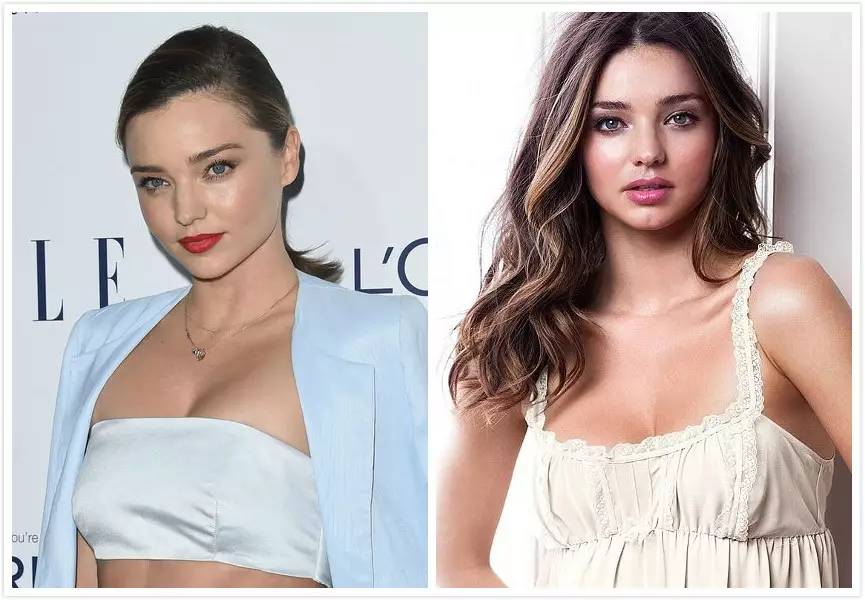 发际线决定人的智商,发际线决定气质