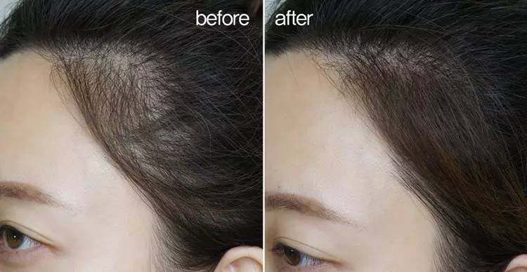 发际线决定人的智商,发际线决定气质