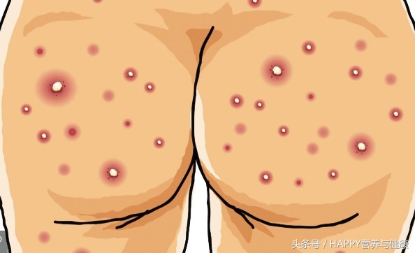 皮肤科怎么治疗长疮,皮肤疮的症状有哪些