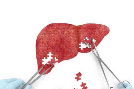 乙肝加糖尿病的早期症状,乙肝肝硬化早期什么症状