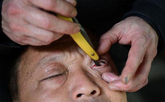 总感觉眼睛干涩怎么回事,总感觉眼睛又酸又干涩是什么原因