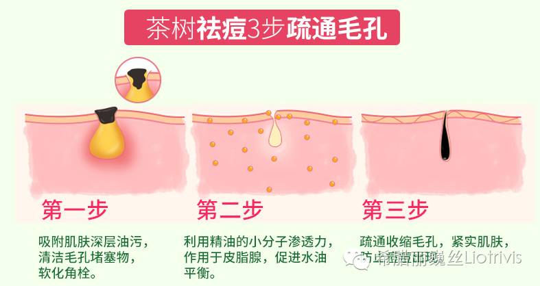 用了茶树精油祛痘脸上干燥起皮 (茶树祛痘凝胶精油功效怎么样)