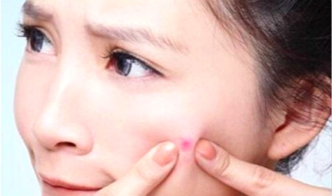 「湿气重」易长痘，用这几招最见效