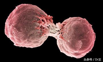 虽没化疗快速，让癌细胞自动凋亡！罹癌率降低73%！堪比偏方！