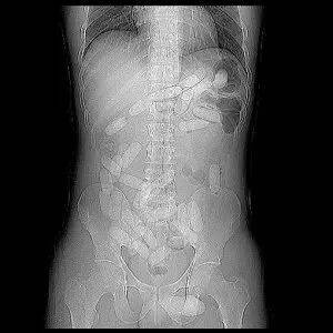 藏毒方式大揭秘，哪一种最新奇？