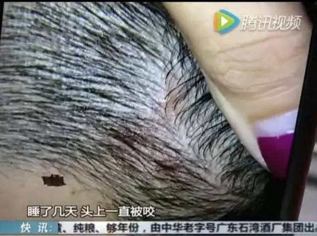 这种枕头爬出上千只虫,这种枕头大家都爱用