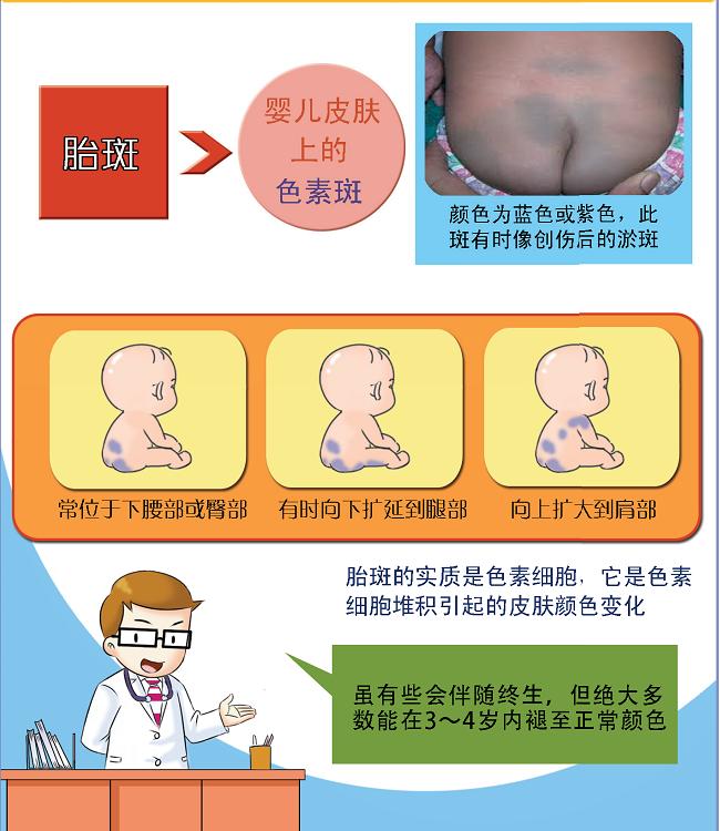 宝宝身上有哪些胎记,有胎记的小孩儿是不是天使