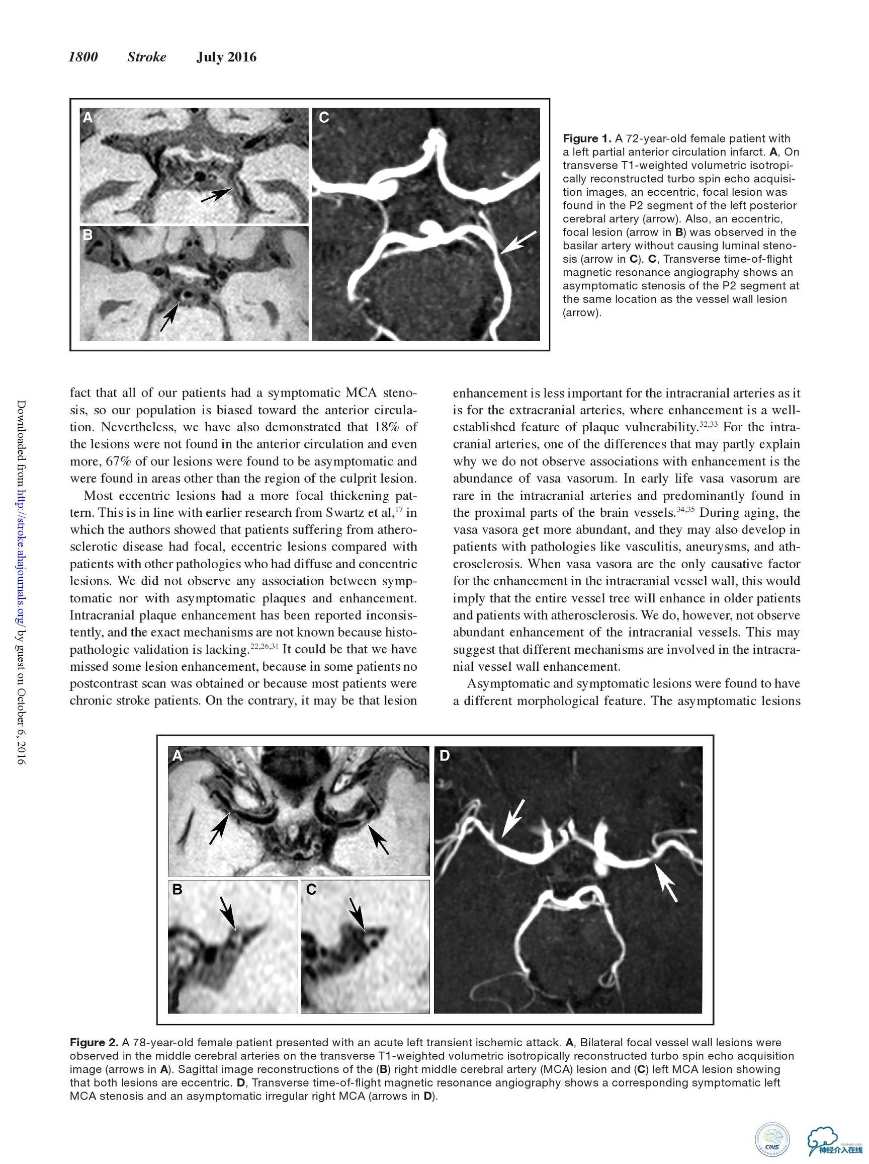 动脉粥样硬化疾病的影像诊断,脑动脉粥样硬化大脑的形态学变化