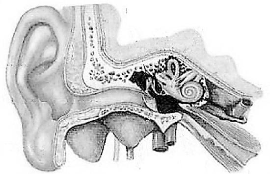 一女子耳石脱落,女子耳石脱落怎么治疗