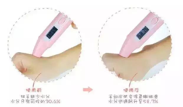 秋冬手部干燥粗糙肿么办？用对产品让你摆脱大妈手！