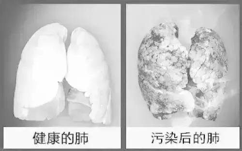 北京肺癌能治好吗,北京肺癌治疗新进展