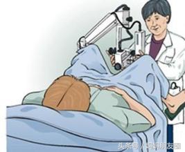 曾经流产、生育过，医生能不能一眼看穿