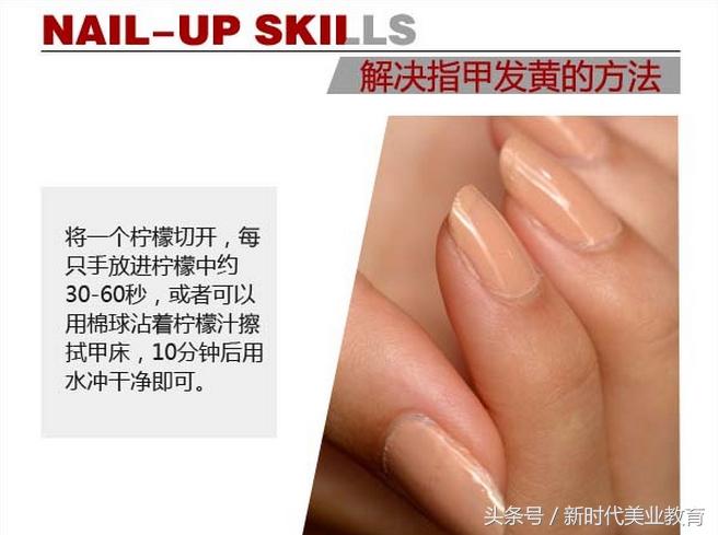 美甲指甲变绿了怎么处理,美甲白指甲发黄