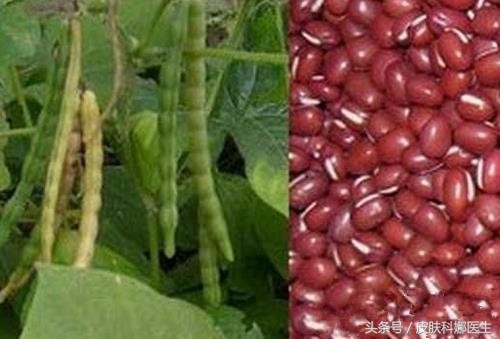 脓疱痔疮最快根除方法,痔疮肿痛出血严重有什么民间药方