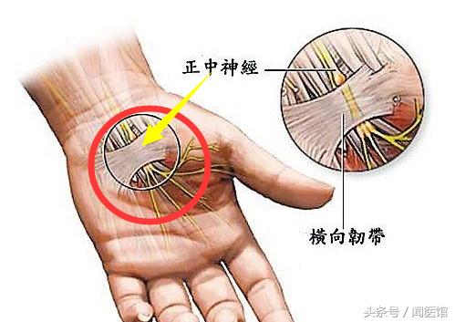 跟着练：握紧拳头，再松开，出现握拳无力、手抖晃动真要关注了