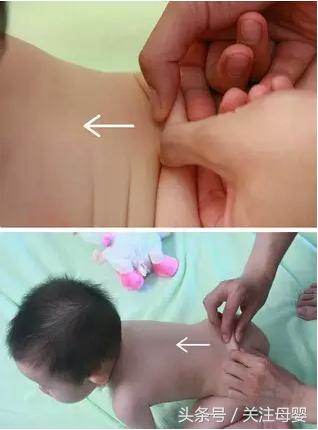 扁桃体发炎咳嗽怎么办小儿推拿,小儿推拿全套视频教程咳嗽感冒