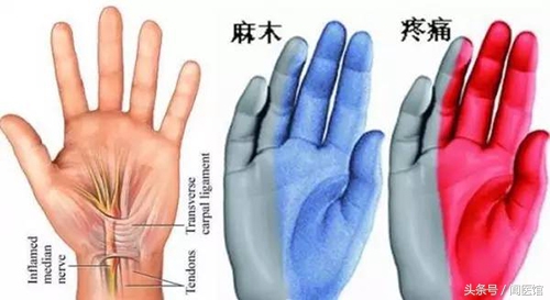 跟着练：握紧拳头，再松开，出现握拳无力、手抖晃动真要关注了