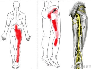 翘二郎腿的时候腿上有个包,比翘二郎腿更不好的坐姿