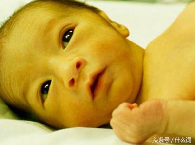 新生儿黄疸11需要吃退黄疸的药吗,新生儿头部黄疸和身上黄疸不一样
