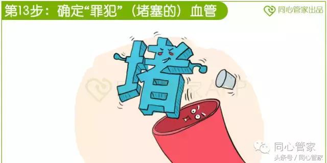 急性心梗心脏骤停如何抢救,急性心梗抢救过来后遗症会怎样