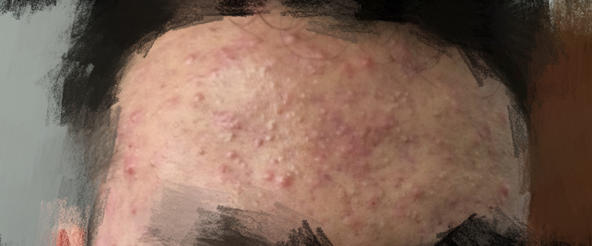 护肤一百问答,女孩健身护肤知识问答