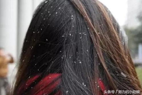 头上为什么会有螨虫？阿婆用一勺盐祛螨，千万螨虫落荒而逃