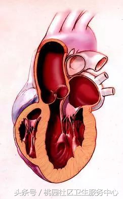 心脏支架说明书,这份通俗易懂的心脏说明书请收好