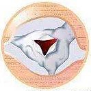 心脏支架说明书,这份通俗易懂的心脏说明书请收好