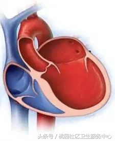 心脏支架说明书,这份通俗易懂的心脏说明书请收好