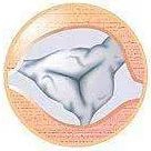 心脏支架说明书,这份通俗易懂的心脏说明书请收好