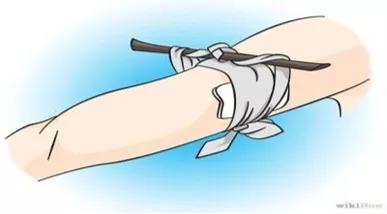 干货！国家体育总局运动医学博士的总结：运动损伤的急救和预防