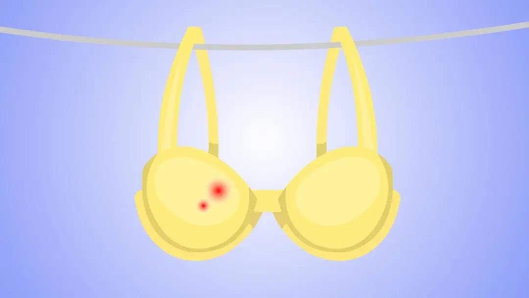 生娃后，4种妇科病别乱治！花了冤枉钱还伤身体